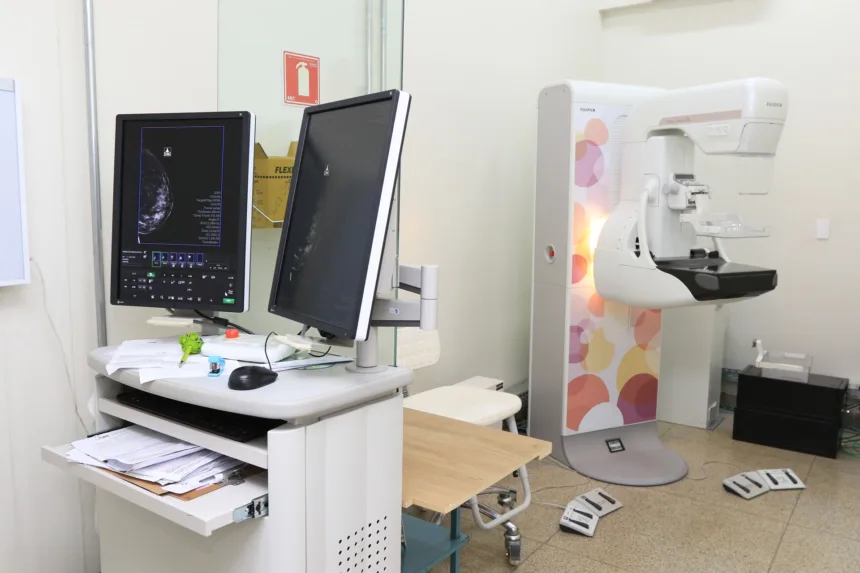 Governo amplia mamografias para zerar fila de espera - Agita Brasília
